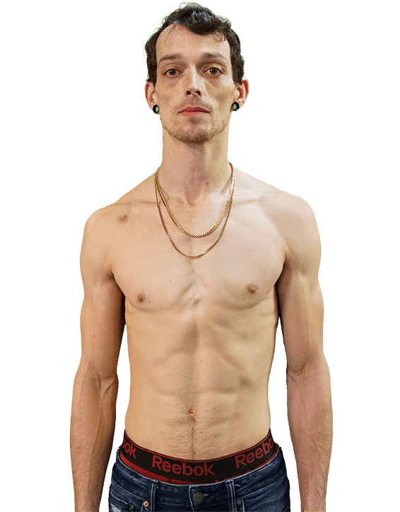 Josh Frasch
