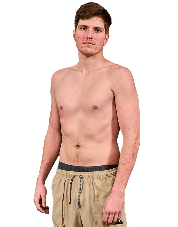 Bjorn Sonsteng